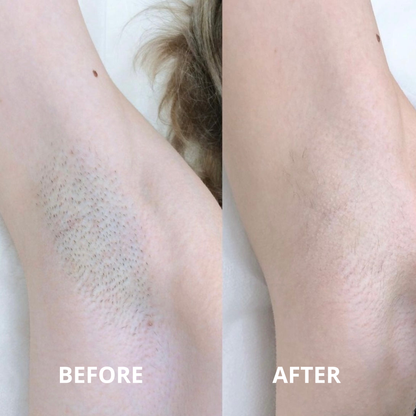 BarePear Smooth Shaver